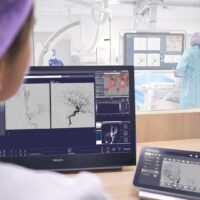 Philips e World Stroke Organization lanciano un documento programmatico per rivoluzionare la cura dell’ictus